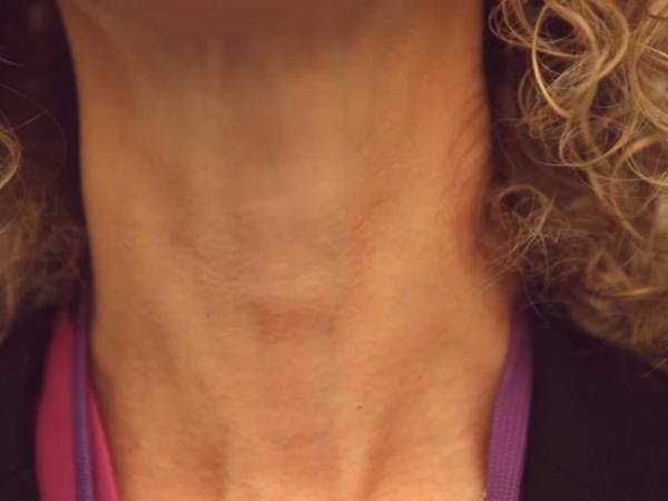 Kako z vodo in ogledalom prepoznati težave s ščitnico